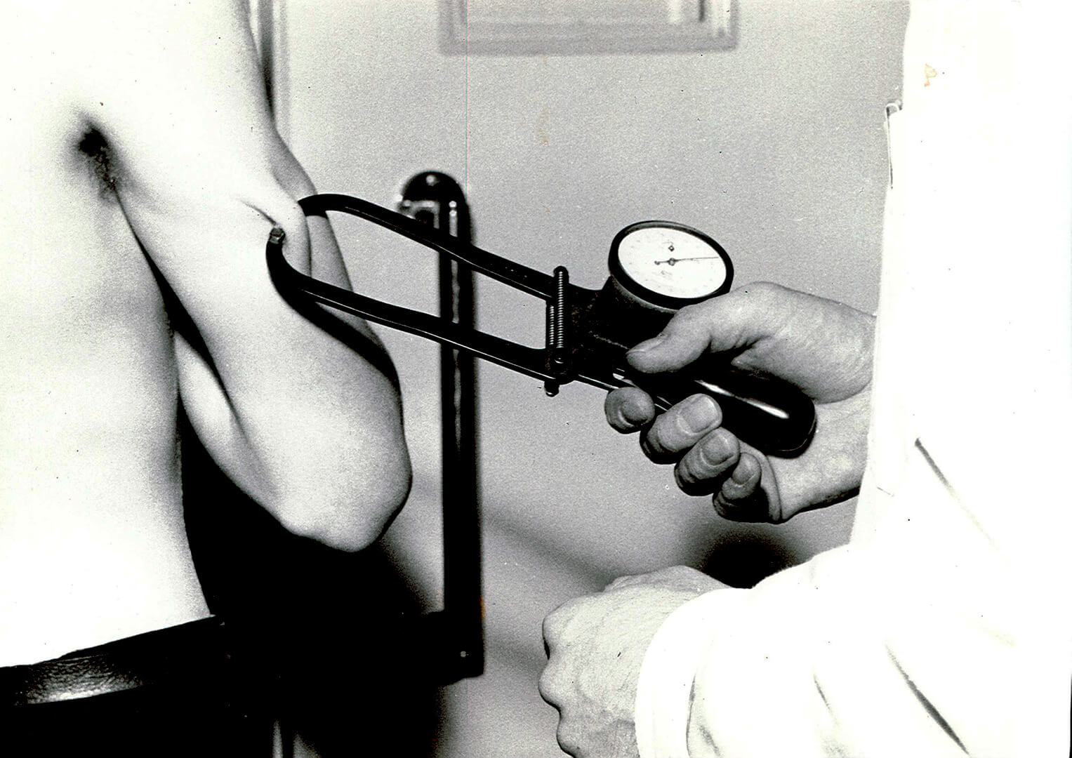 Ihopoimun mittausta Skin-fold-mittarilla autoklinikalla vuonna 1967.